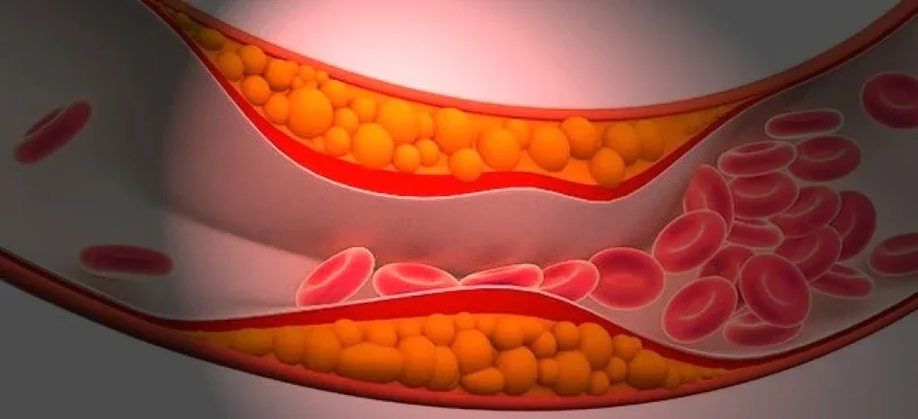 Redução de triglicérides